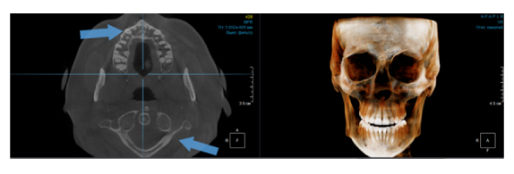 Критерии выбора конусно-лучевого компьютерного томографа.-04 (1).jpg