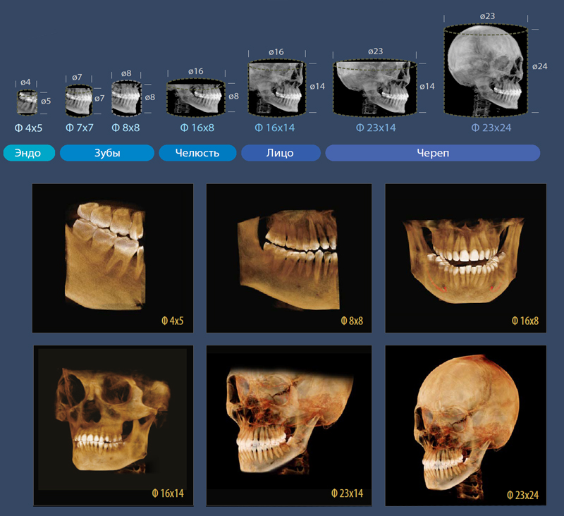 Области сканирования Papaya.jpg