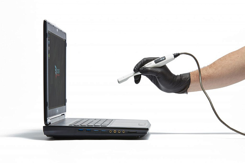 Condor - интраоральный сканер