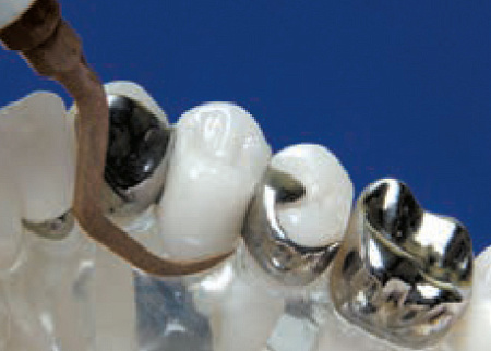 Acteon насадка для скайлера PH1 – из карбонового композита, для полировки и чистки керамических и композитных виниров, вкладок, обработки шеек имплантатов и протезов, полировки металлических (золото, титан) поверхностей