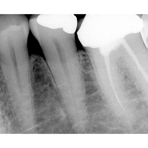 Suni Dr.Suni Plus - система компьютерной радиовизиографии