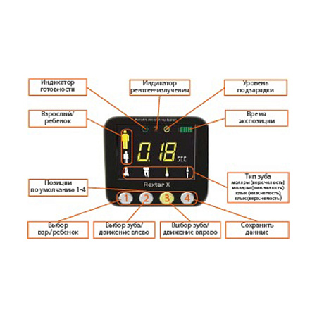 POSDION Rextar - портативный рентген